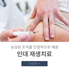 인대 재생치료
